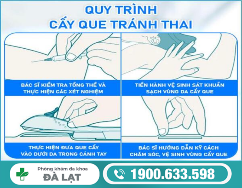 Hình ảnh minh họa